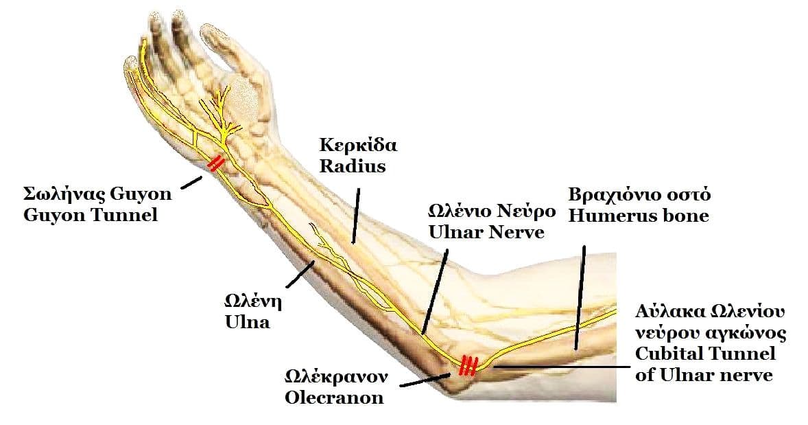 Ulnar neuropathy at the elbow - Wikipedia