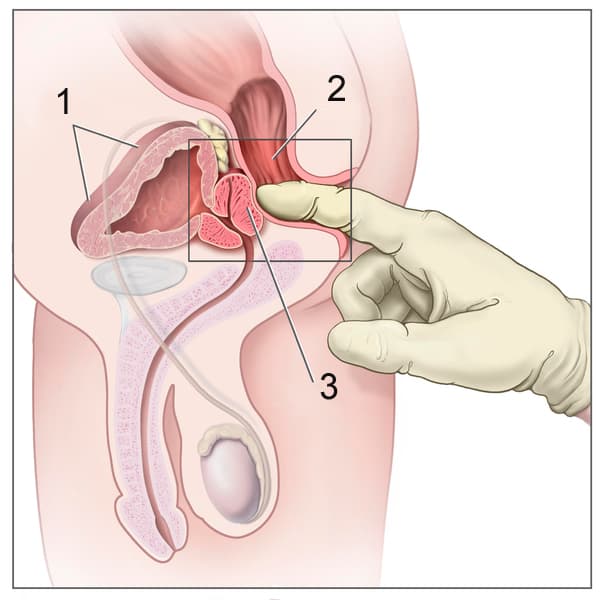 Toucher rectal — Wikipédia