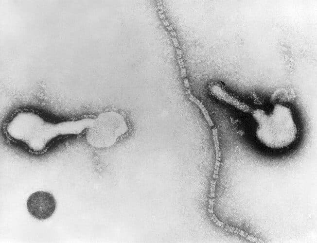 Parainfluenza — Wikipédia