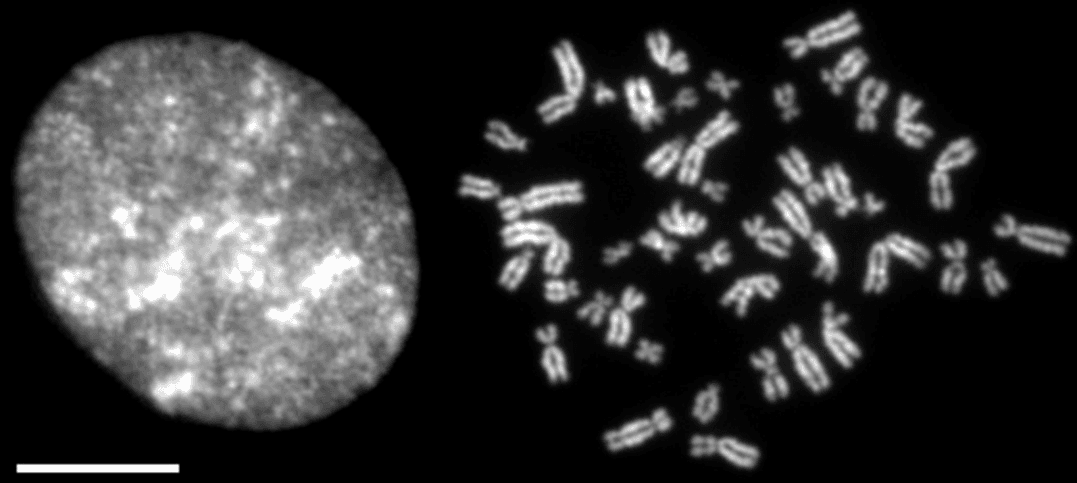 Condensin - Wikipedia