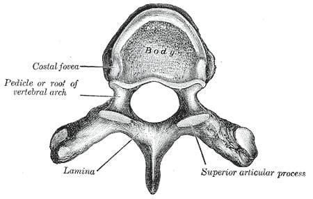Laminectomy - Wikipedia
