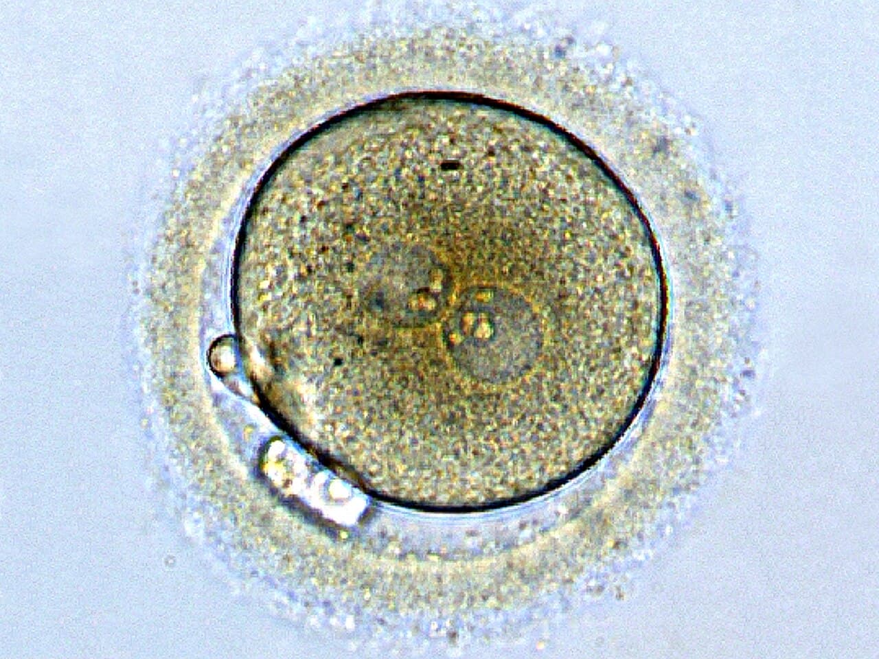 Zygote - Wikipedia