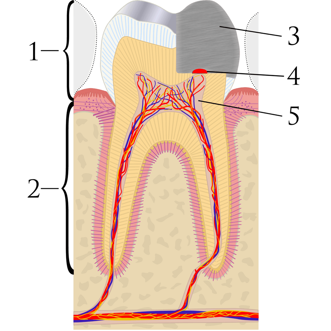 Pulp capping - Wikipedia