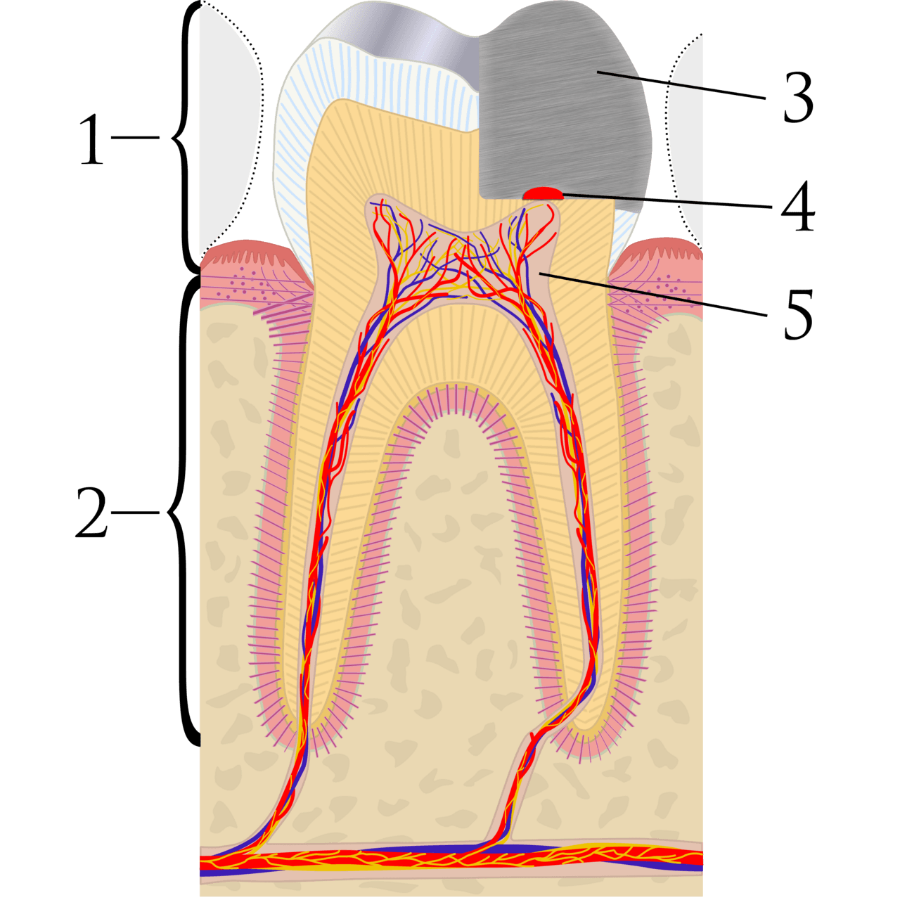 Pulp capping - Wikipedia