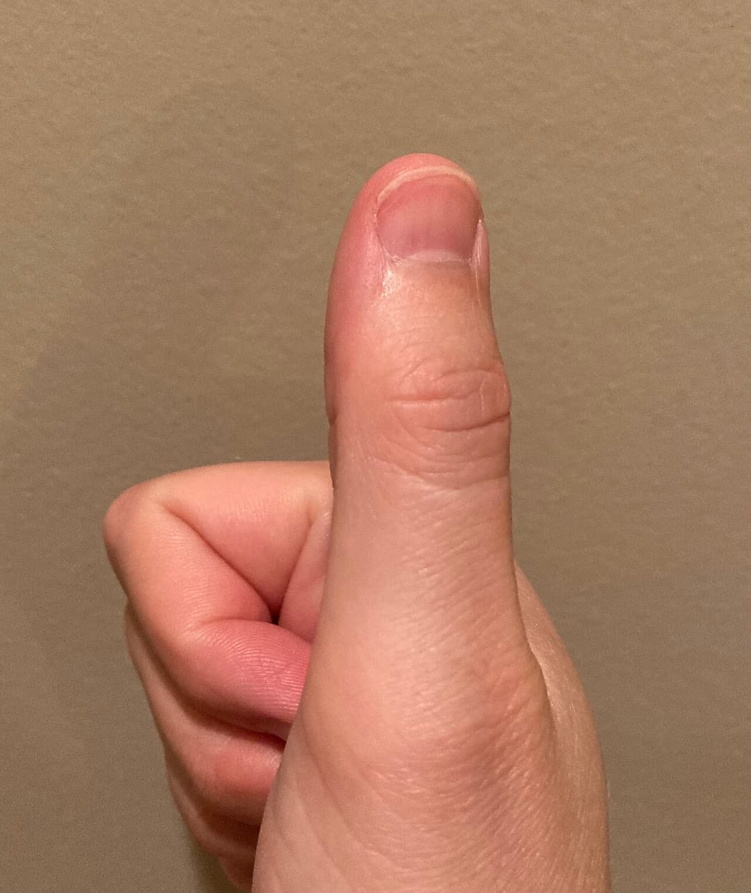 Thumb - Wikipedia
