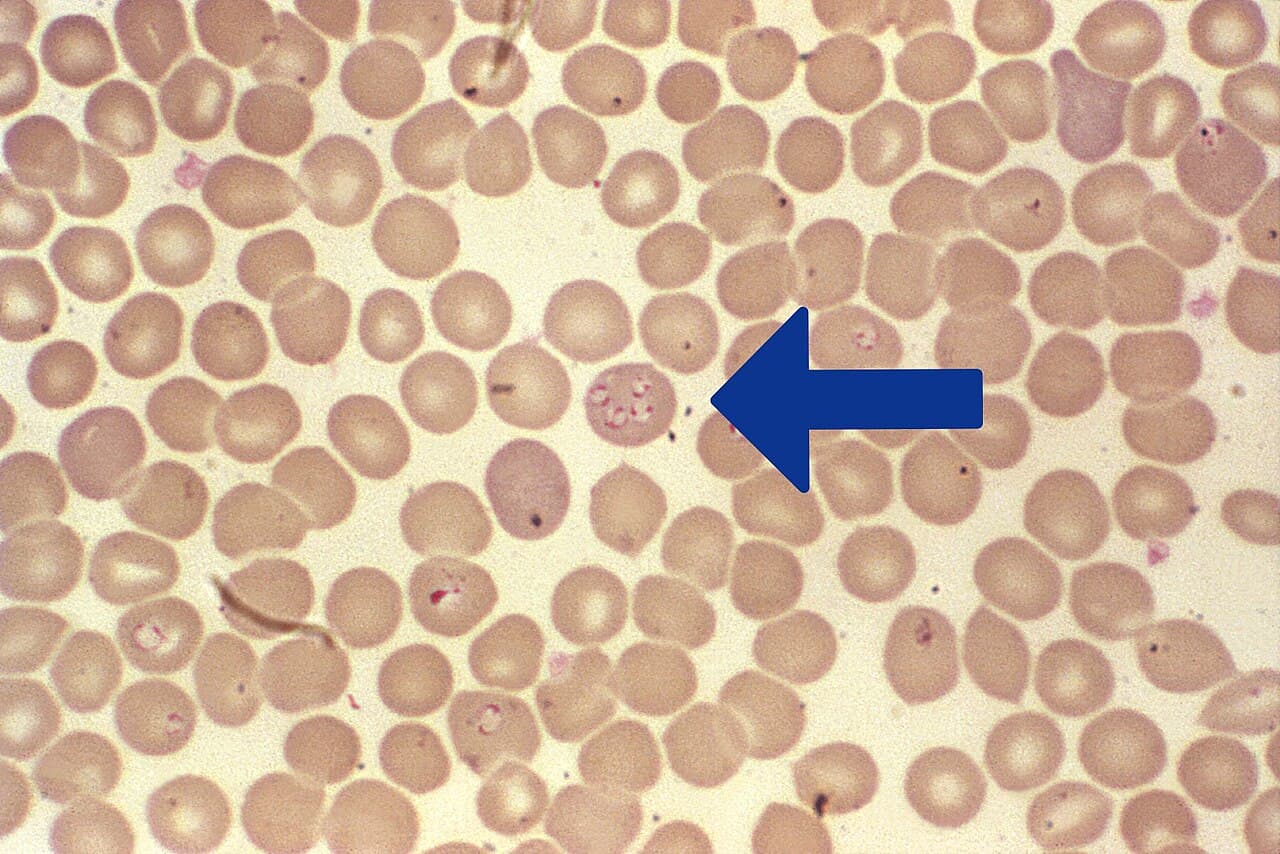 Babesia — Wikipédia