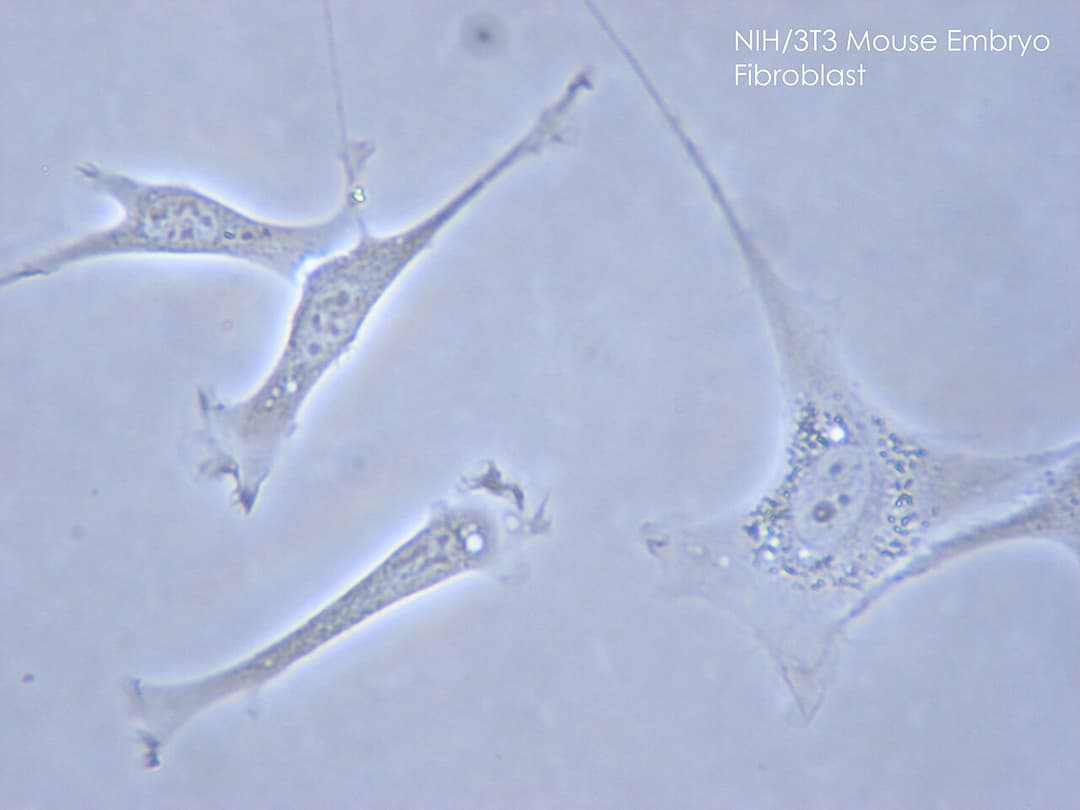 Fibroblast - Wikipedia