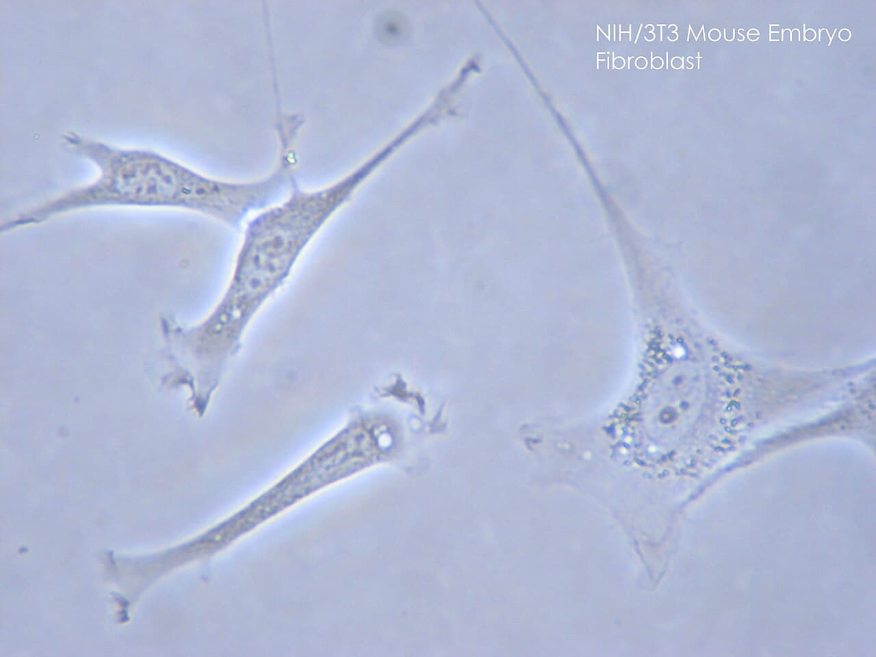 Fibroblast - Wikipedia