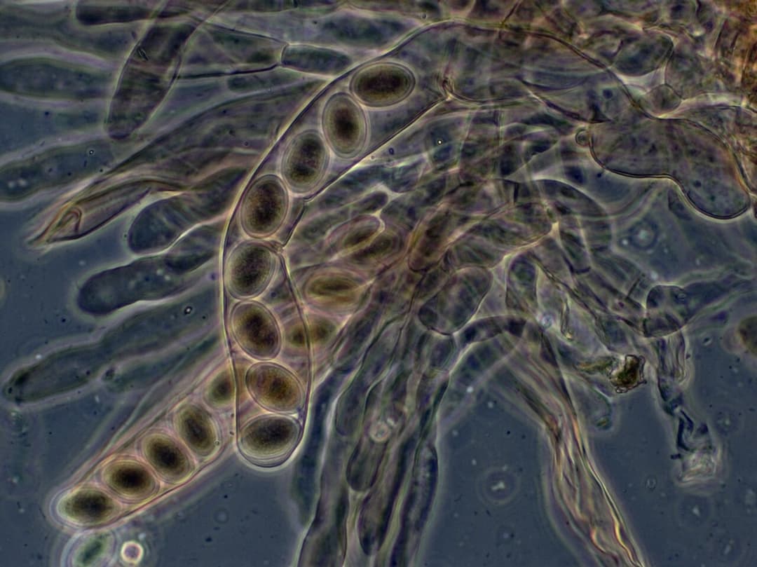 Ascus - Wikipedia