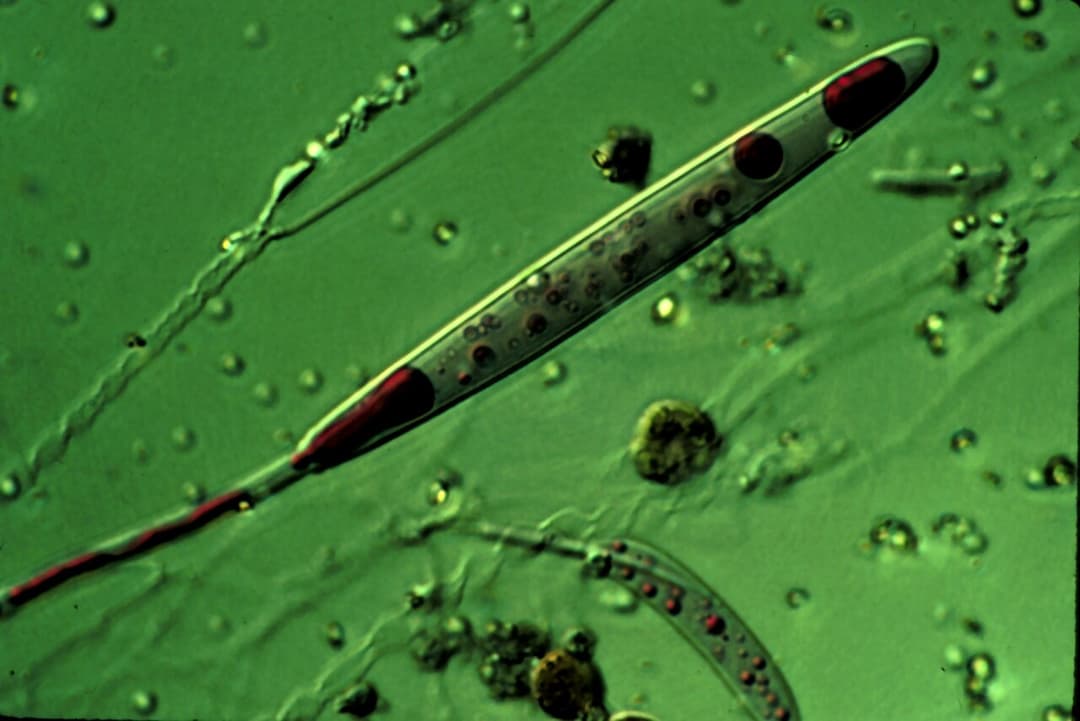 Cnidocyte - Wikipedia