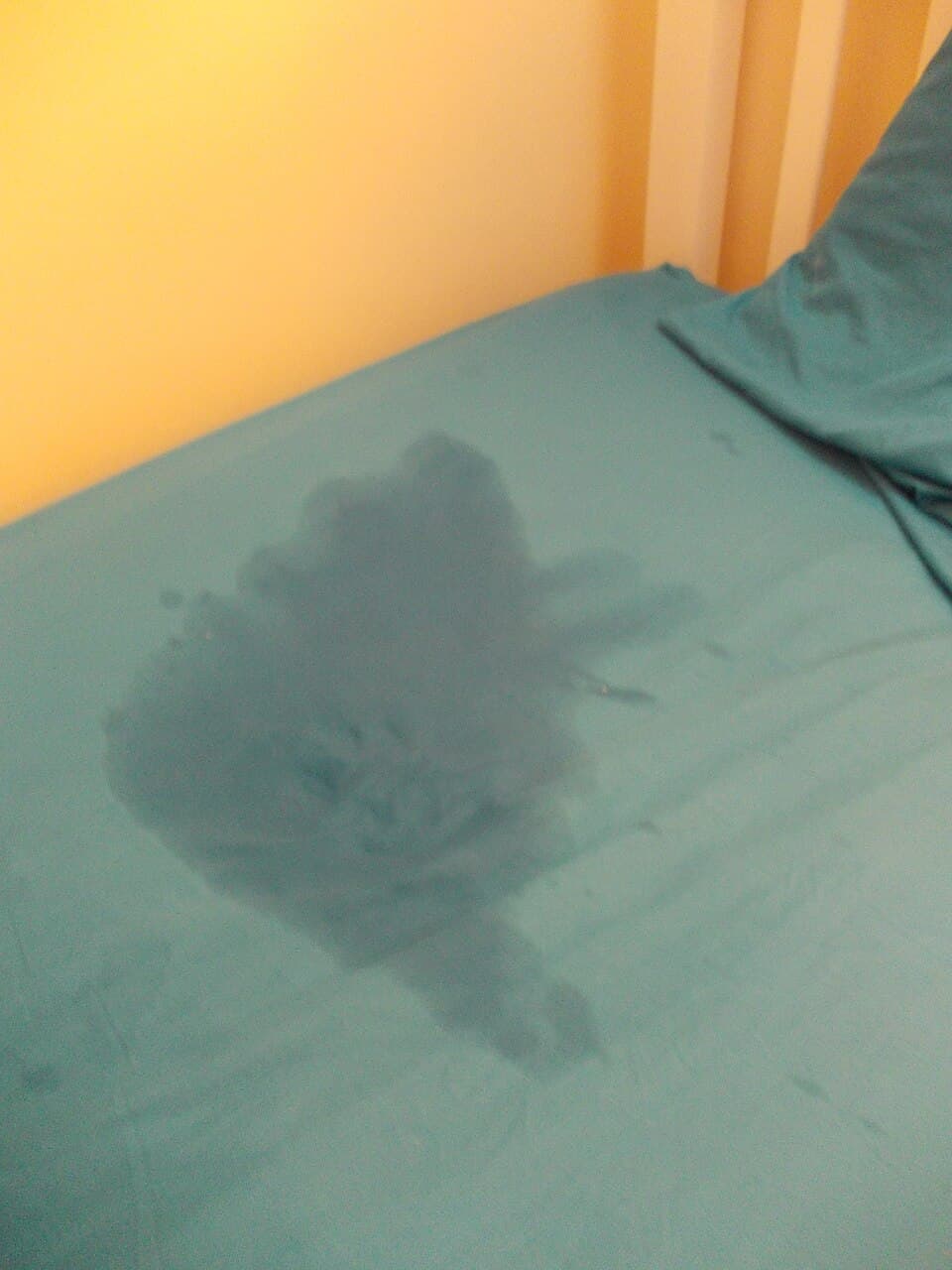 Nocturnal enuresis - Wikipedia