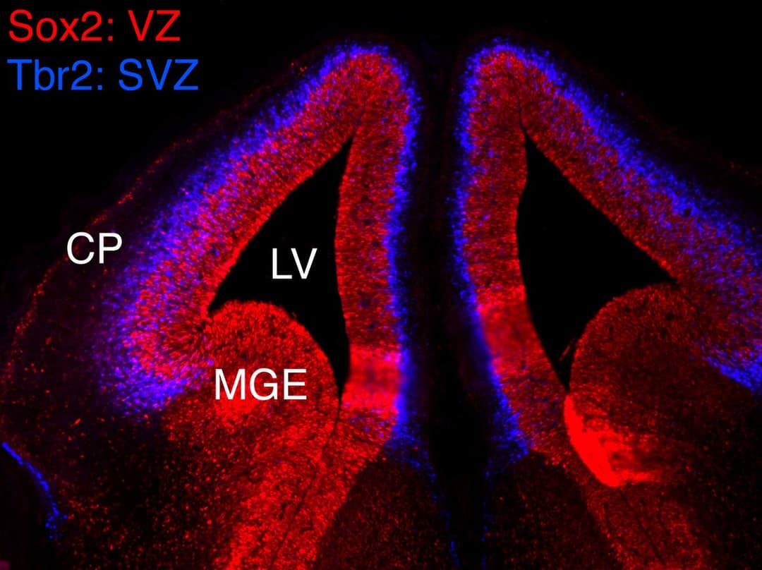 Ventricular zone - Wikipedia