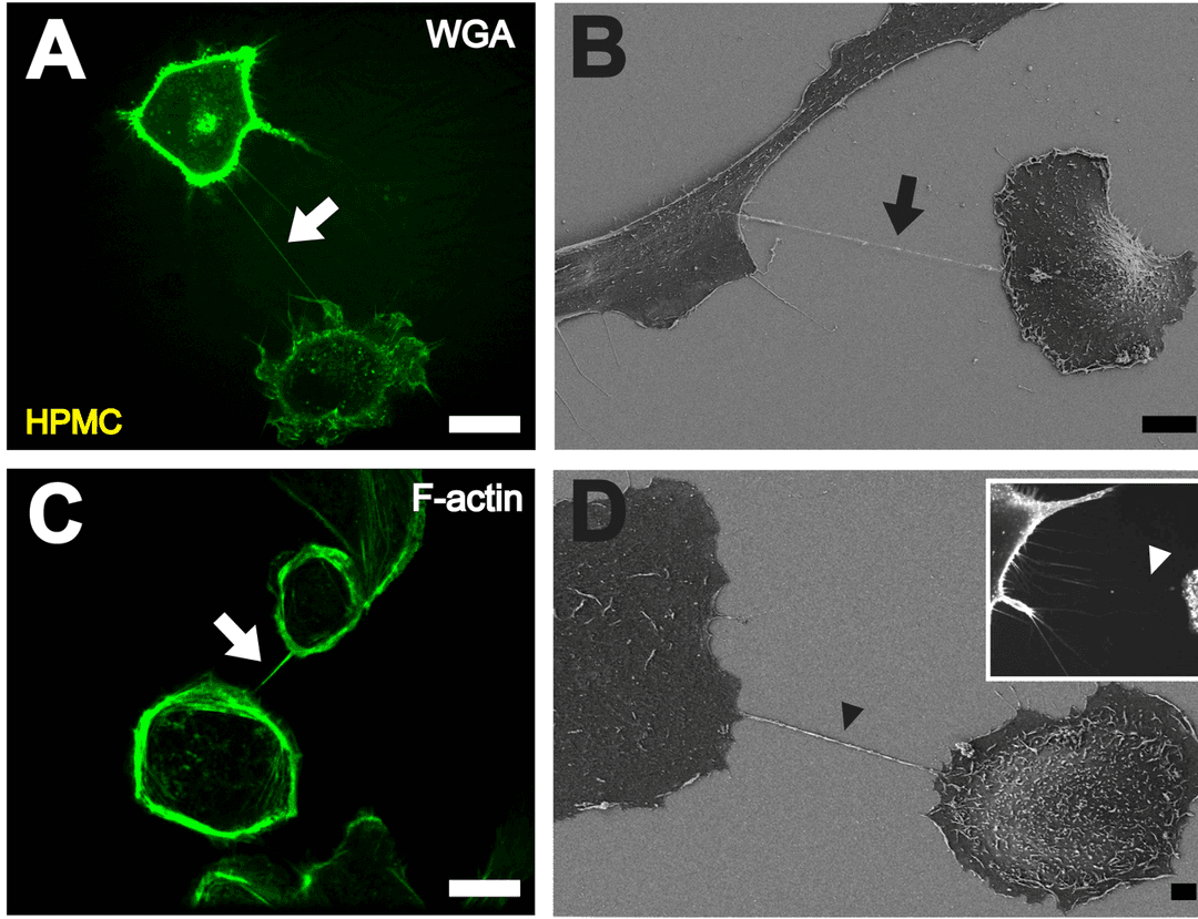 Tunneling nanotube - Wikipedia