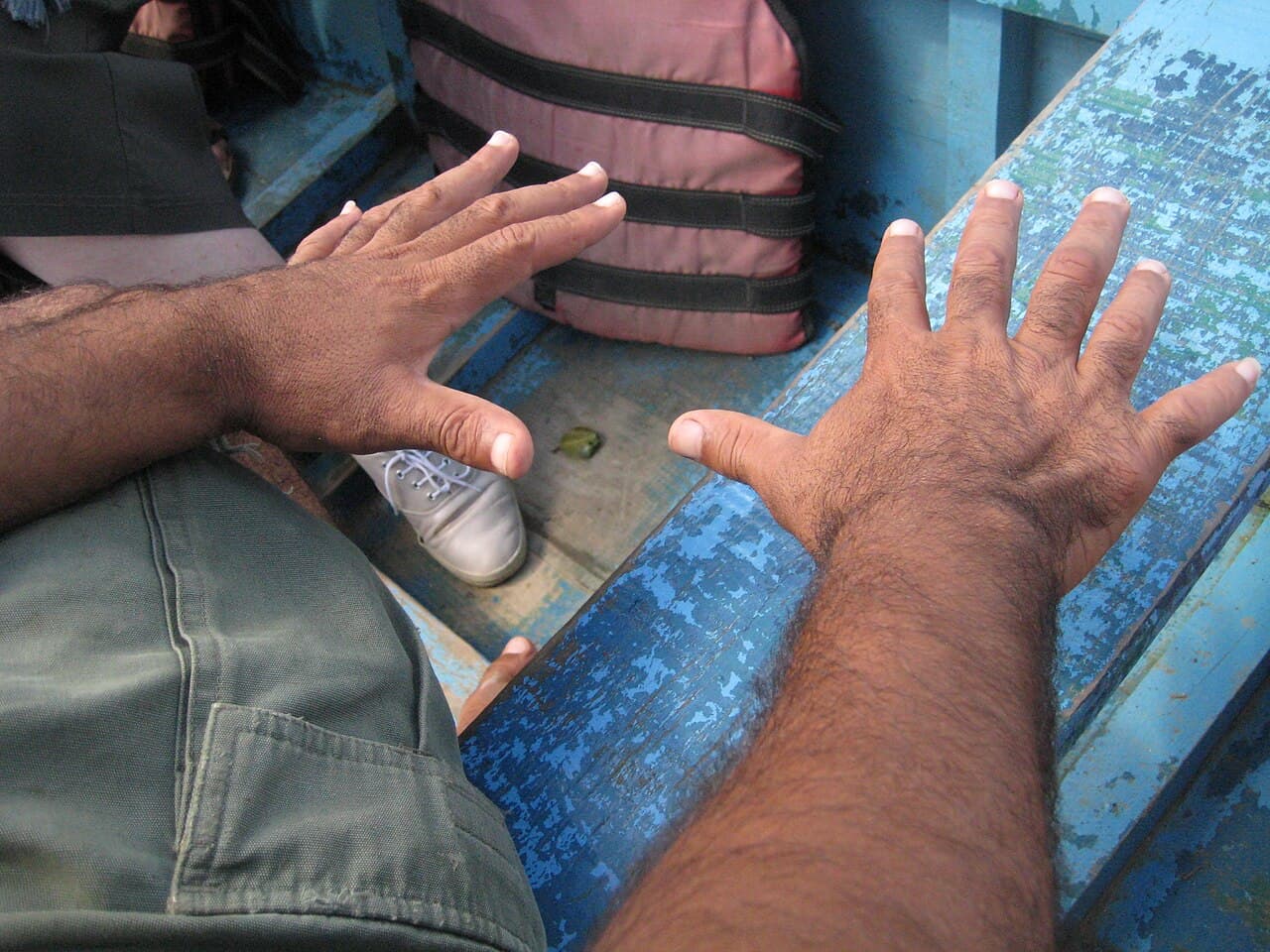 Maladie congénitale — Wikipédia