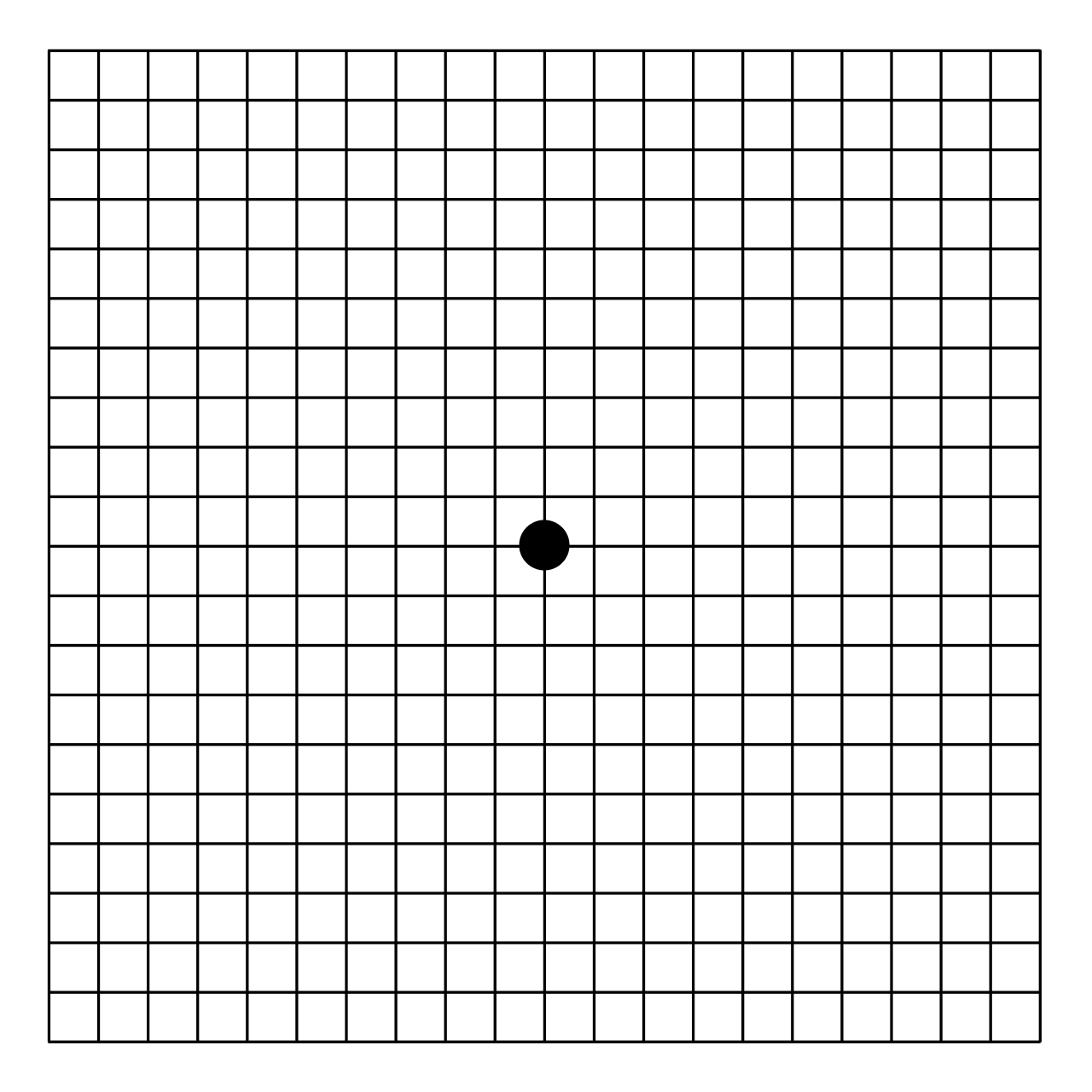 Amsler grid - Wikipedia