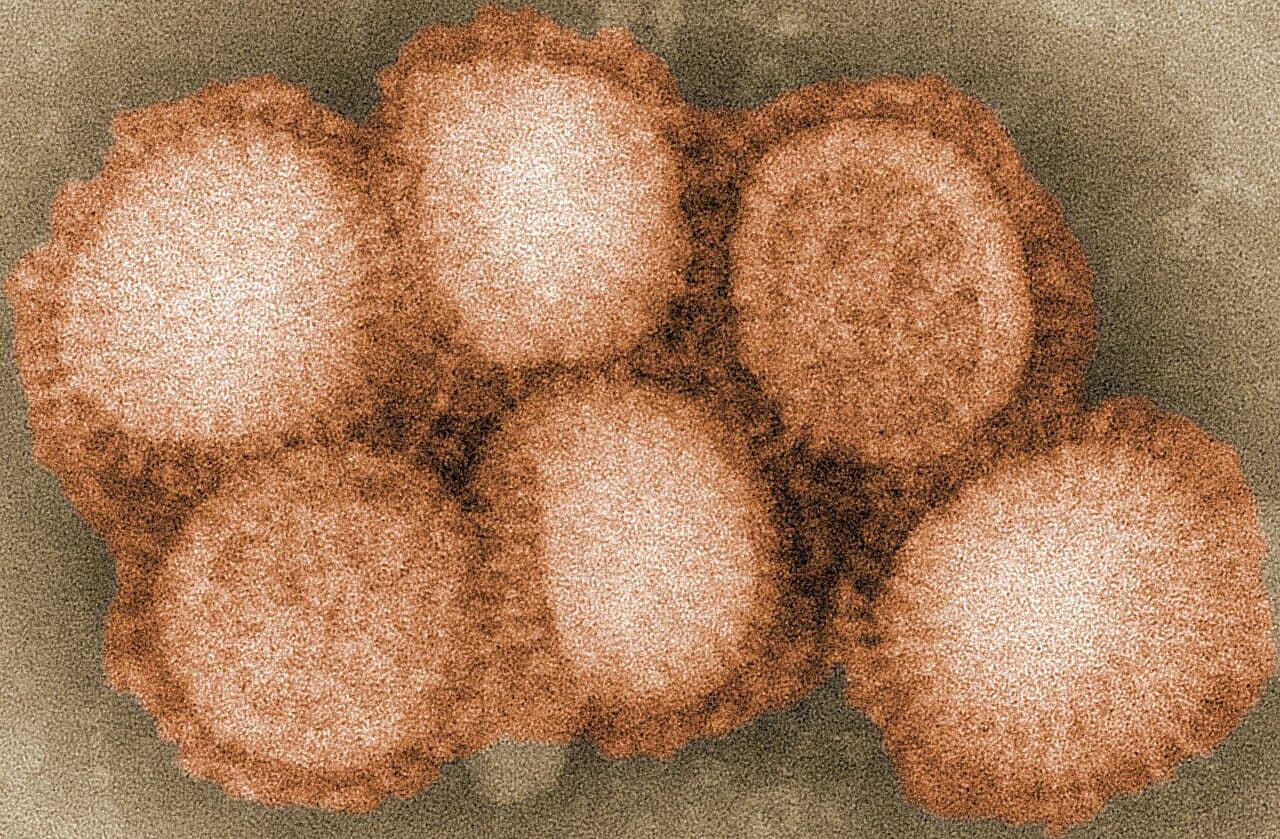 Avian influenza - Wikipedia