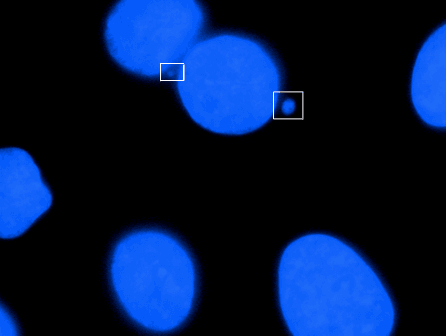 Micronucleus - Wikipedia