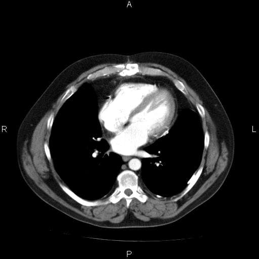 Picture archiving and communication system - Wikipedia